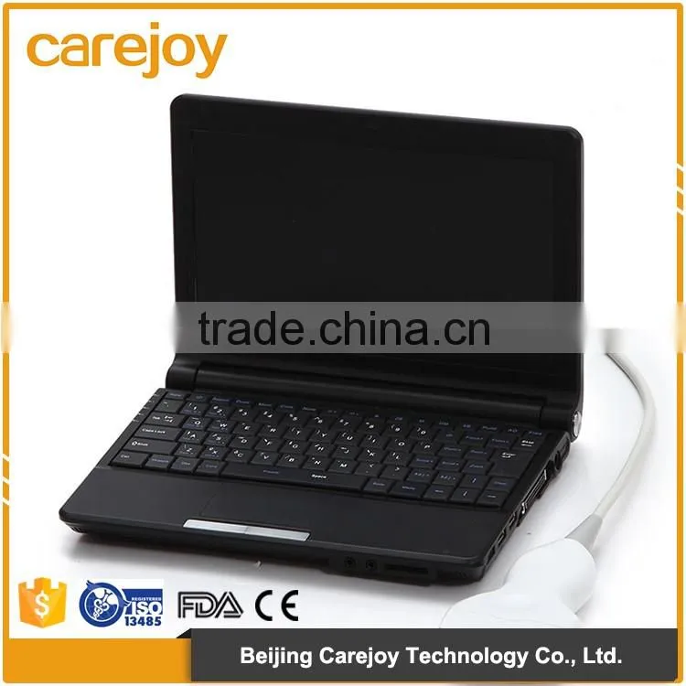 White+Bule wholesale Medical Supplier digital Ultrasound Machine for Pregnancy