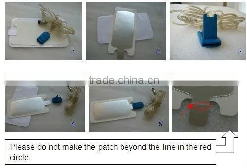 Professional 532nm, 1064nm ND Yag Laser hair removal, tattoo removal Multifunction Beauty Equipment