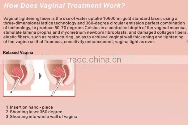Skin care device co2 fractional laser scar removal machine for hot sell