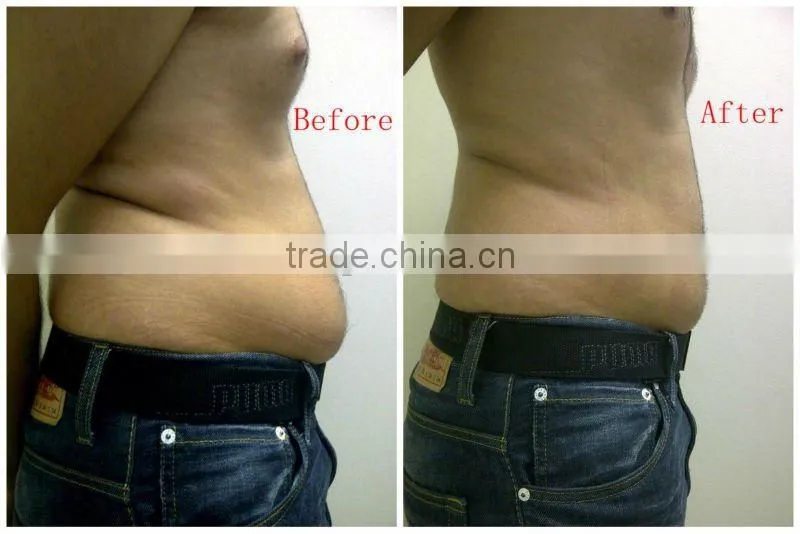liposuction equipment home slimming devices with low price F006