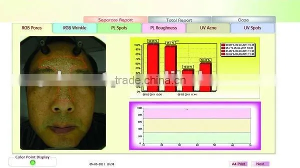 WT-03-S Super Trispectrum Magic mirror skin scanner analyzer
