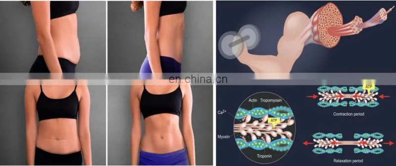 4 in 1 body sculpting machine of muscle building machine for fat removal