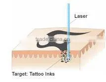 best tattoo removal laser 1064/532 nd yag laser beauty studio machine