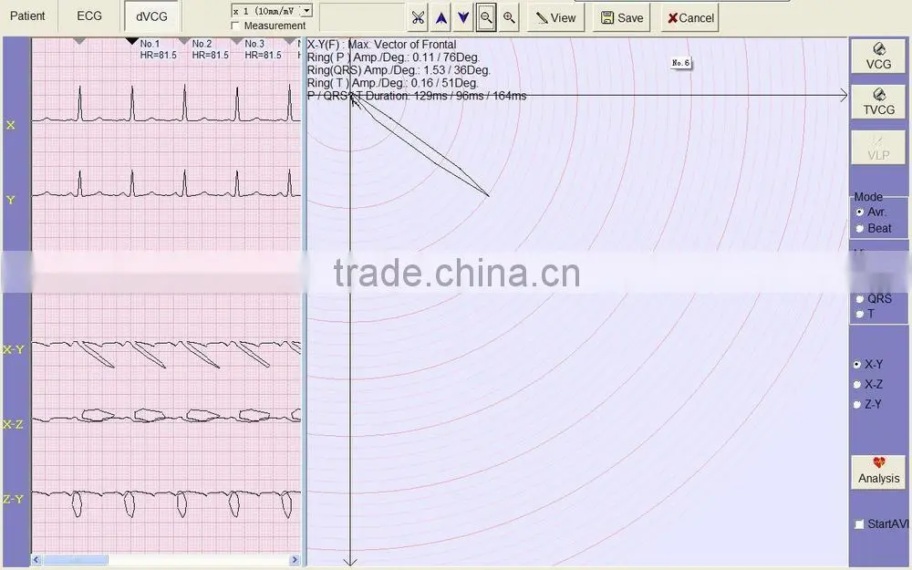Model:3306G 6ch color touch display veterinary ecg