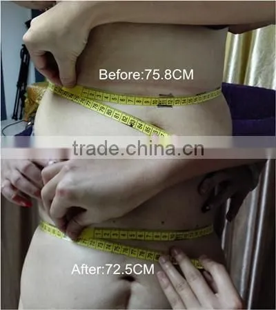 GLM Ultrasonic HIFU fat reduction HIFU body slimming