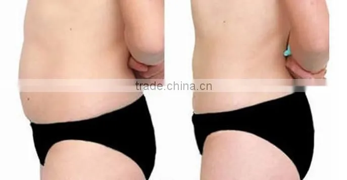 newest Cryolipolysis fat freeze Slimming lose weight machine for obesity