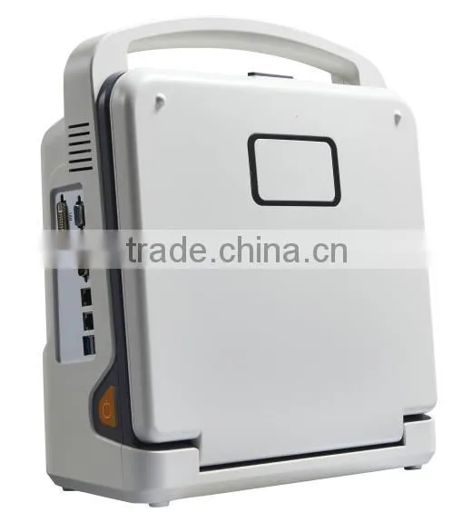 Color Doppler Ultrasound