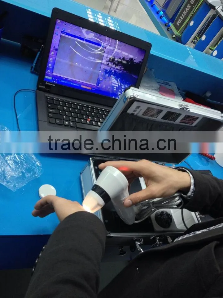 the best GuangzhouGD622 TV freeze-frame skin and hair testing machine/skin analysis machine