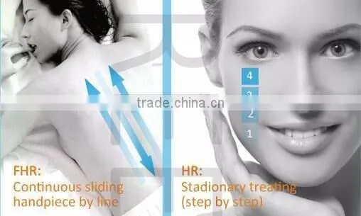 Hot Sale Large Spot Size Laser 808 Hair Removal Laser Epilation Home