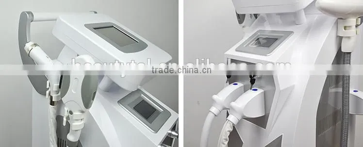 High quality laser nd yag of ipl shr beauty machine