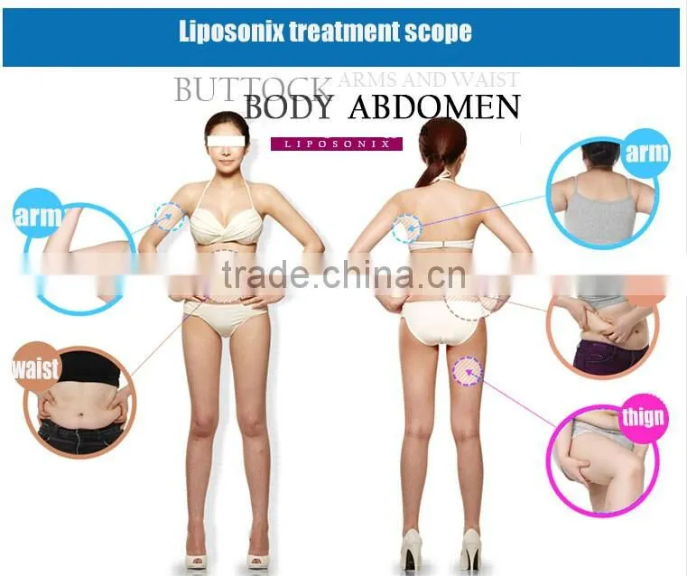 liposonix machine hifu body liposonix slimming machine lipo laser weight loss machine liposonix