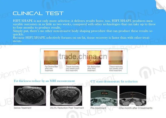 Best body weight loss machine HIFU slimming beauty equipment Nubway