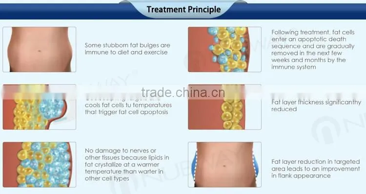 CE / FDA approved 10.4 inch touch screen popular body shaping cool lipo sculpting fat weight loss cool sculpting machines