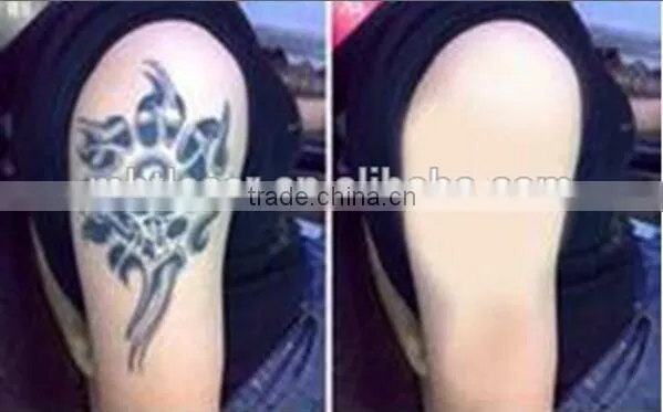 professional nd yag tattoo removal machine CE/ISO approve 1064nm,532nm can removal alll kind of color tattoo