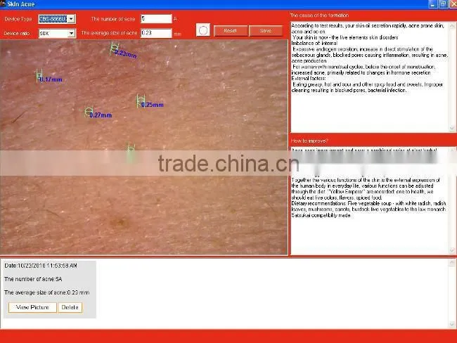 Promotion price !!!!! skin analysis system a-one