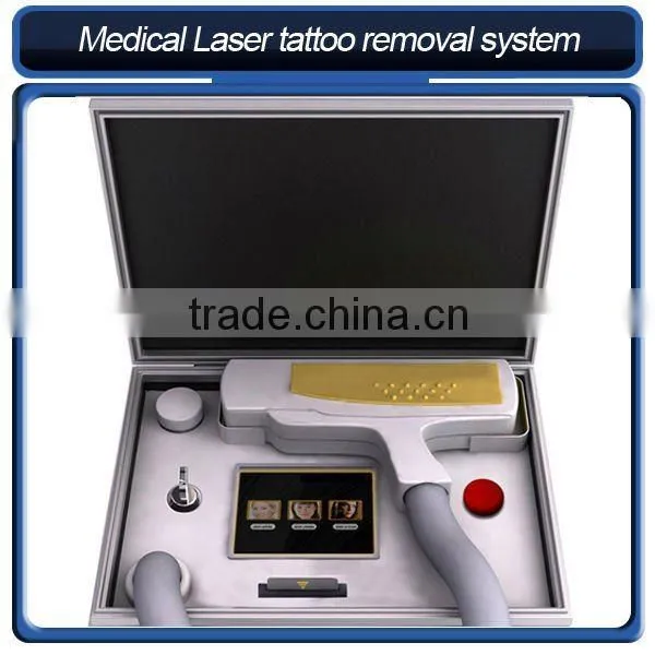 q switched nd yag laser tattoo removal
