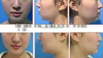 Cheap antique color touch screen ipl depilatory