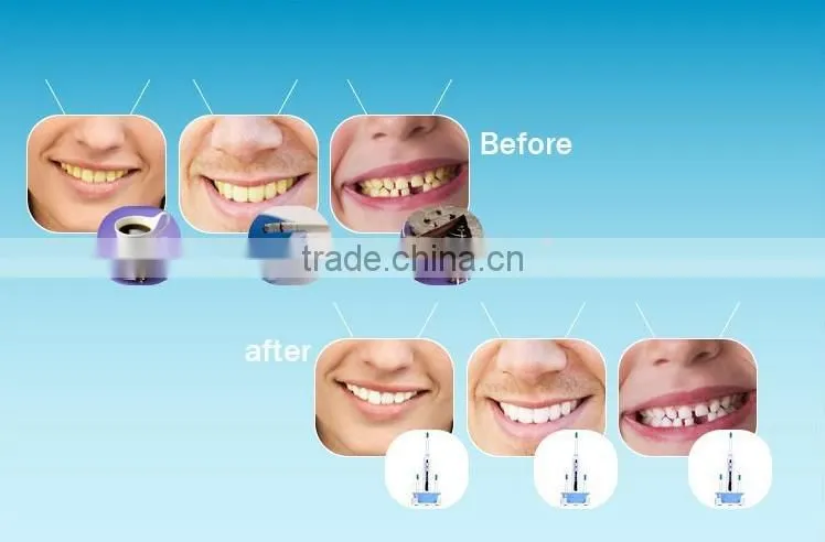 Children rechargeable electrical Toothbrush