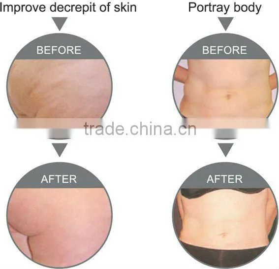 multifuntional (hair removal and body slimming ) beauty machine (ipl +rf+cavitation )