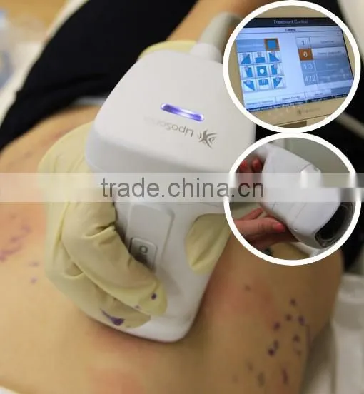 2016 Portable HIFU body Immediate slimming burn fat weight loss professional beauty salon equipment