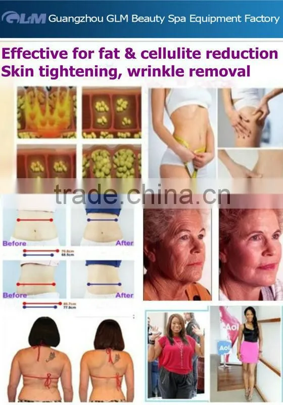 Ultrasonic RF Vacuum Cavitation Machine Laser Weight Loss Machine