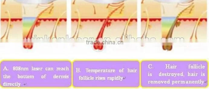 lady epilator hair removal face/good quality device for hair removal face