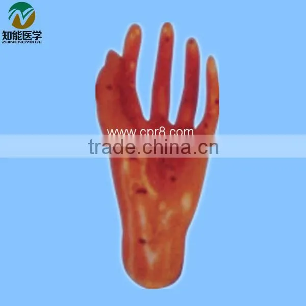 Newly Developed Hand Massage Model BIX-Y1014