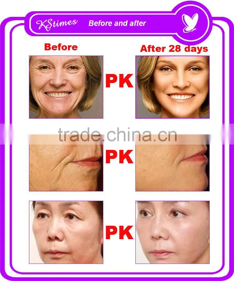 Korean formula Keep young anti-aging wrinkle removal natural anti wrinkle products