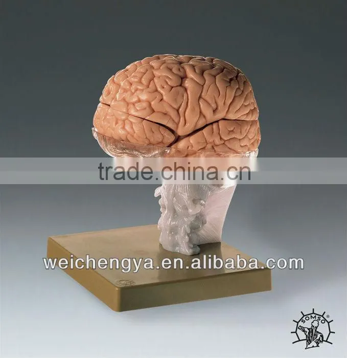 WCY Scale Models Of The Human Brain With Arteries