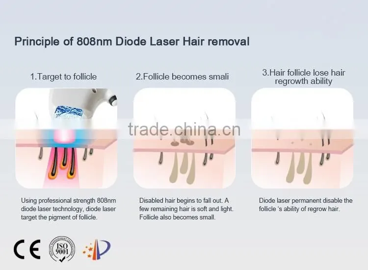 High Power 808nm diode laser permanent hair removal machine