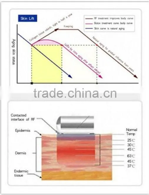 CE approval VY-M2 body shaping skin tightening machine