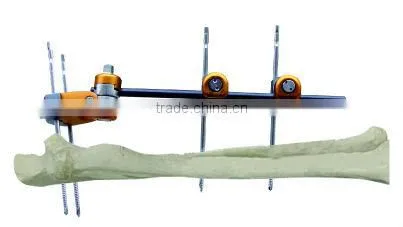 Proximal Ulna Radius Fractures orthopedic external fixation