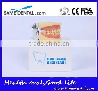 Dental Extraction Model School Teaching Model Teeth Model