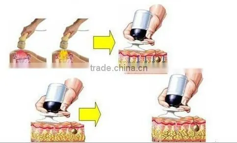 Distributor price!professional cavitation machine for sale