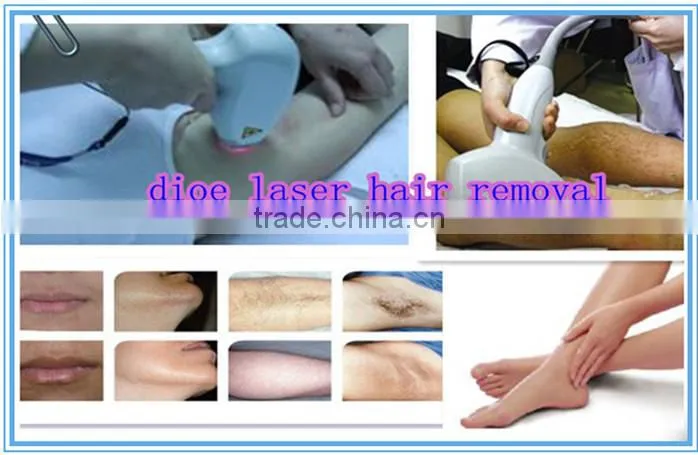 Permanent diode lazer hair removal machine