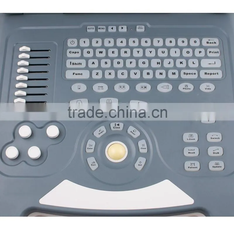 Laptop 15 inch LCD Color Doppler Ultrasound Diagnostic System RUS-9000-2 with CE ISO approved