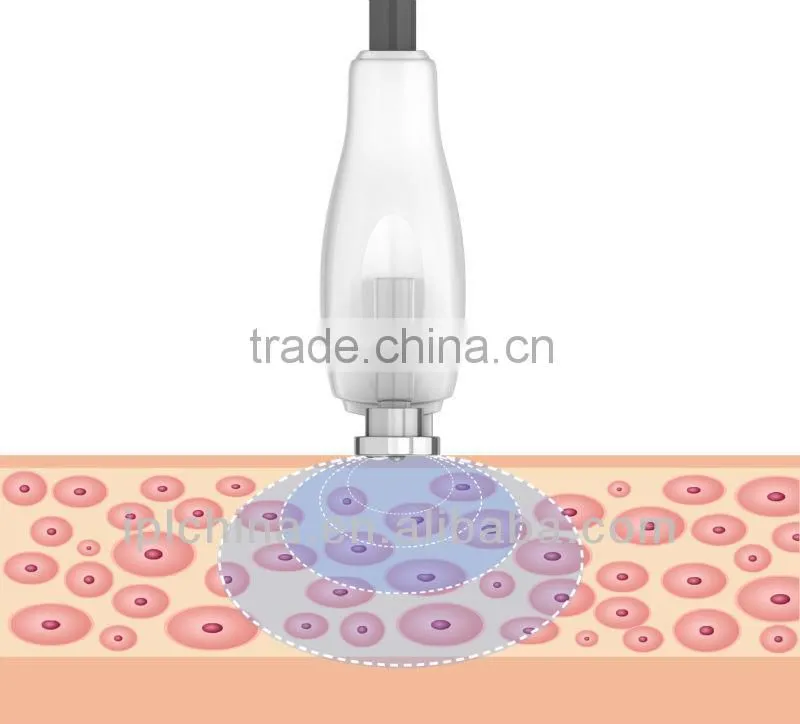 2014 Best Home Laser Skin Tightening Machine-Pixelift