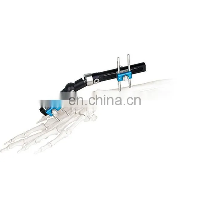 High Quality Wrist Joint External Fixator Orthopedic Surgical Instrument