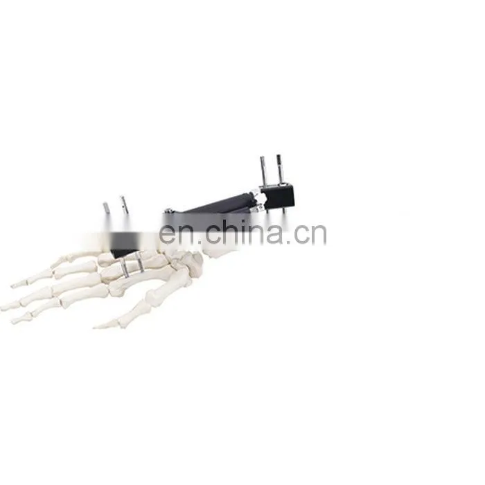 High Quality Wrist Joint External Fixator Orthopedic Surgical Instrument