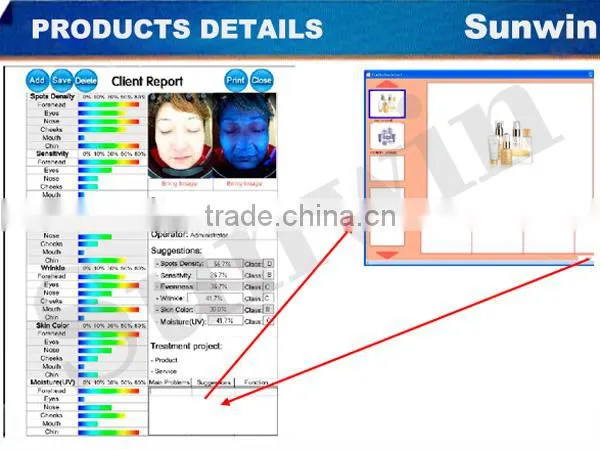 (On Promotion) Professional skin analyzer 3D magic mirror