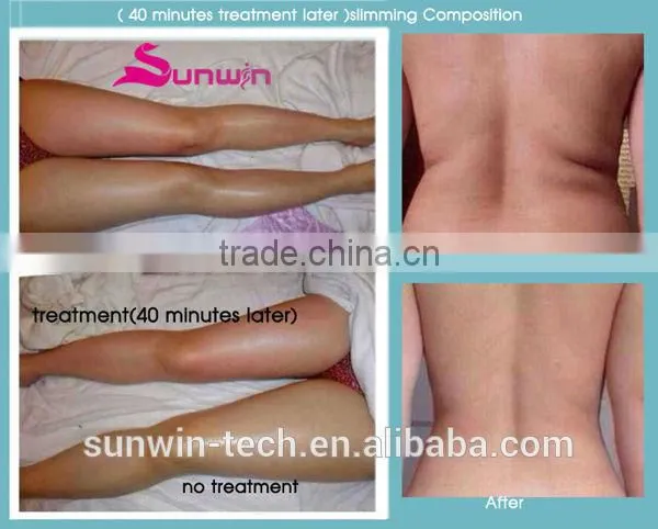 Sunwin SW-29F Forever Top pressotherapy Forever Top pressotherapy machine for cellulite reducing