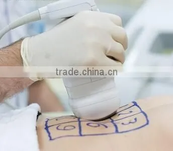 Lipo HIFU /LipoHIFU ultrasound Slimming System HIFU-10