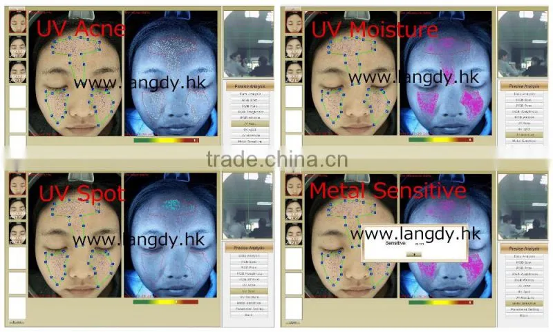 skin and hair analysis machine /skin scrubber facial machine /chemical analysis machine