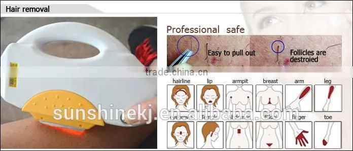 The New Listing hot sale CE approved hair removal equipment shr and ipl