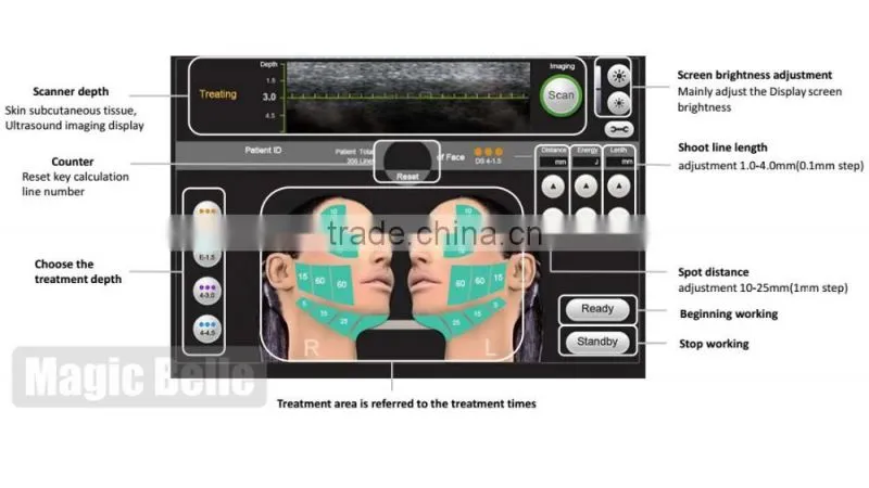 Korea technology hifu face lift slimming machine beauty equipment