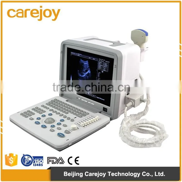 White+Bule wholesale Medical Supplier digital Ultrasound Machine for Pregnancy