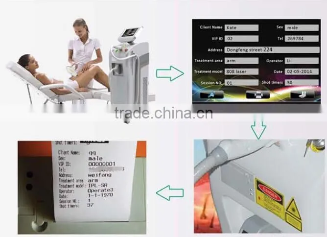 Diode Laser Hair Removal Machine/Laser speed 808nm
