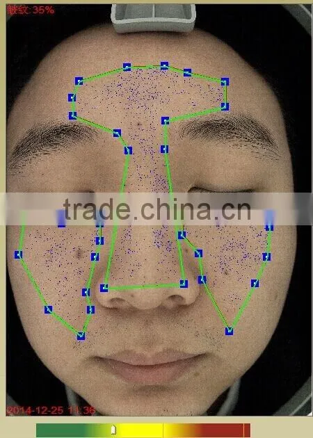 Magic Mirror-Skin Analysis System AYJ-J009