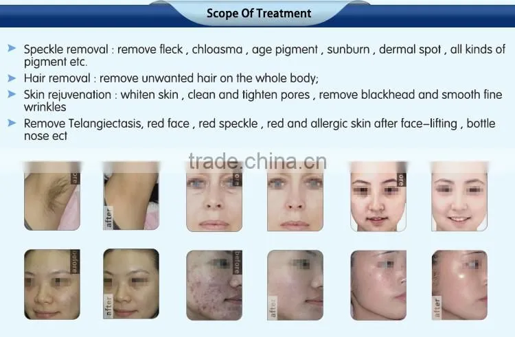 3 in 1 professional multifunctional shr ipl elight hair removal beauty machine anti aging women skin rejuvenation