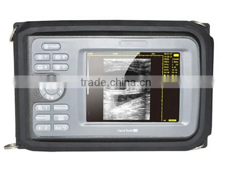 HandScan H8 portable/palm handheld ultrasonic/ ultrasound machine lower price/medical equipment